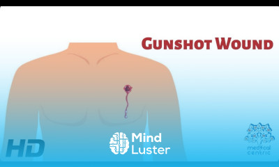 Learn Gunshot Wound Everything You Need To Know Mind Luster