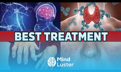 Learn The Best Treatment For All Autoimmune Diseases Mind Luster