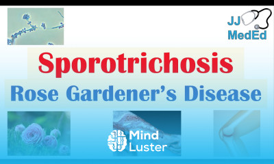 Learn Sporotrichosis Rose Gardener s Disease Causes Risks Types ...