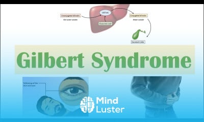 Learn Gilbert Syndrome Causes Genetics Pathogenesis Signs Symptoms ...