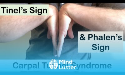 Learn Carpal Tunnel Syndrome Tinel S Sign And Phalen S Sign Clinical Examination Mind Luster