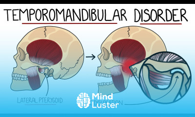 Learn Temporomandibular Joint Disorder Explained TMJ Dysfunction ...