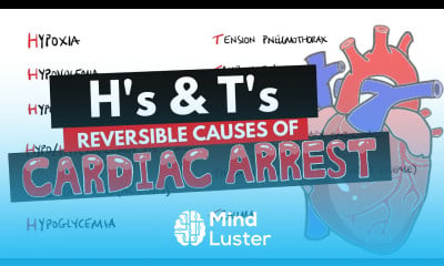 Learn Reversible Causes Of Cardiac Arrest Hs And Ts Mnemonic H S T S ...