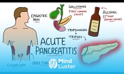 Acute Abdominal Pain Diagnosis Tutorial - Mind Luster