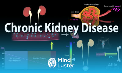 Learn Chronic Kidney Disease Animation - Mind Luster