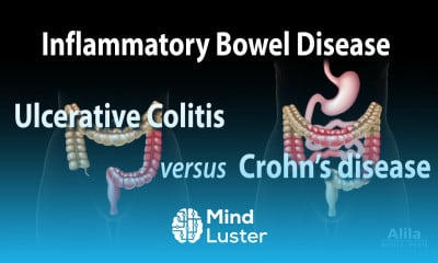 Learn Ulcerative Colitis versus Crohn s Disease Animation - Mind Luster