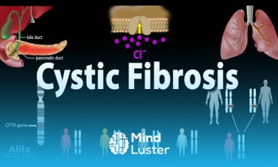 Cystic Fibrosis Symptoms And Treatments Tutorial - Mind Luster