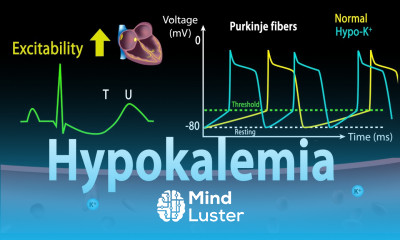 Learn Hypokalemia Causes Symptoms Effects on the Heart Pathophysiology ...