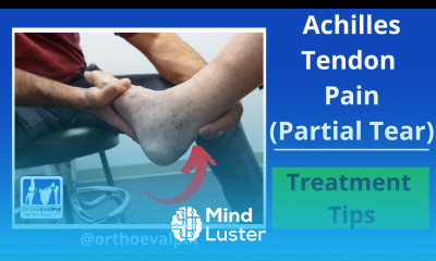 Learn Achilles Tendon Pain Partial Tear - Mind Luster