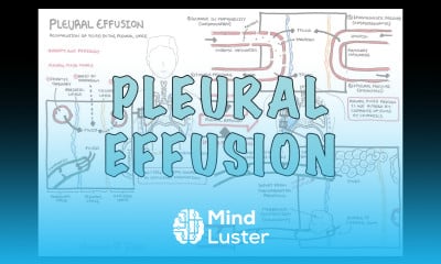 Learn Pleural Effusion DETAILED pathophysiology signs and symptoms ...