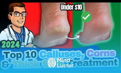 Learn How to REMOVE Thick Dry Skin Calluses Corns HOME Remedies - Mind ...