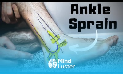 Learn Twisted or Rolled Ankle Sprain Treatment FASTER Home Recovery