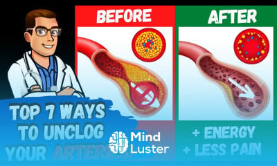 Learn Reverse Your Clogged Stiff Arteries 50 Atherosclerosis Over 45 