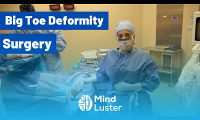 Learn Big Toe Deformity Before and After Cosmetic Foot Surgery with Dr ...